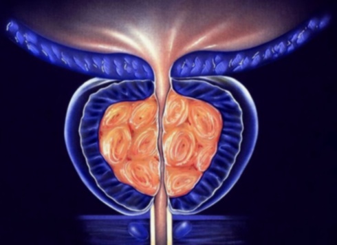 traitement HBP générique